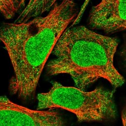 PTPN4 Antibody, Novus Biologicals 0.1 mL | Buy Online | Novus Biologicals | Fisher Scientific